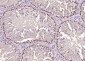 phospho-HSP70 (Tyr611) Rabbit pAb